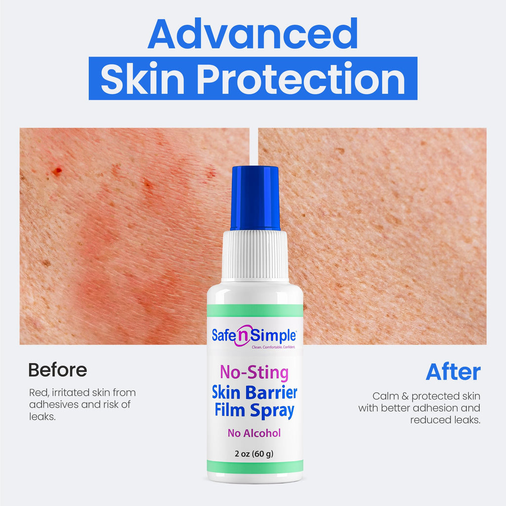Skin Barrier Spray 2oz Alcohol-Free D770256